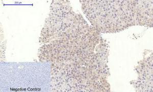 Immunohistochemical analysis of paraffin-embedded rat liver tissue using Anti-RhoA Antibody at 1:200 (4°C overnight). Negative control was secondary antibody only.