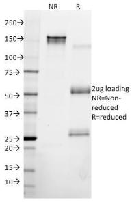 SDS-PAGE analysis of Anti-Cytokeratin 8 Antibody [KRT8/2115] under non-reduced and reduced conditions; showing intact IgG and intact heavy and light chains, respectively. SDS-PAGE analysis confirms the integrity and purity of the antibody