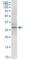 Anti-RGS5 Rabbit Polyclonal Antibody