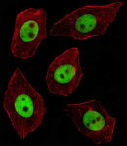 Anti-GTF2I Rabbit Polyclonal Antibody (AP (Alkaline Phosphatase))