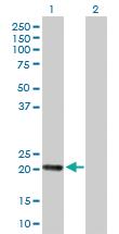 Anti-RGS5 Rabbit Polyclonal Antibody