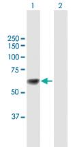 Anti-UGT1A9 Mouse Polyclonal Antibody