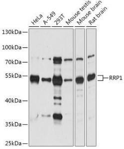 Western blot analysis of extracts of various cell lines, using Anti-RRP1 Antibody (A305631) at 1:1000 dilution. The secondary Antibody was Goat Anti-Rabbit IgG H&L Antibody (HRP) at 1:10000 dilution.