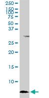 Anti-ATOX1 Mouse Monoclonal Antibody [clone: 3A1]