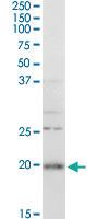 Anti-RGS5 Rabbit Polyclonal Antibody