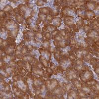 Anti-ST7L Rabbit Polyclonal Antibody