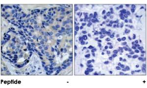 Anti-PTK2B Rabbit Polyclonal Antibody