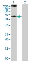 Anti-PIP4K2A Rabbit Polyclonal Antibody