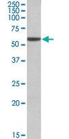 Anti-ALDH3A1 Goat Polyclonal Antibody