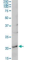 Anti-RGS5 Rabbit Polyclonal Antibody