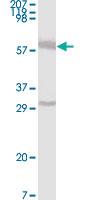 Anti-ESR1 Mouse Monoclonal Antibody [clone: 2B7]