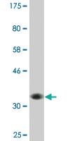 Anti-HIP1R Mouse Monoclonal Antibody [clone: 3E10]