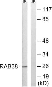 Western blot analysis of lysates from Jurkat cells using Anti-RAB38 Antibody The right hand lane represents a negative control, where the antibody is blocked by the immunising peptide