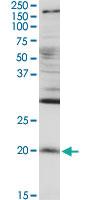 Anti-RGS5 Rabbit Polyclonal Antibody