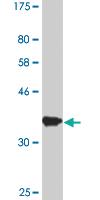 Anti-IMP7 Mouse Monoclonal Antibody [clone: 4G6]