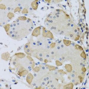 Immunohistochemistry of paraffin-embedded human stomach using Anti-ANAPC10 Antibody (A8330) at dilution of 1:100 (40X lens)