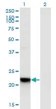 Anti-RGS5 Mouse Monoclonal Antibody [clone: 4E12]