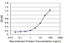 Anti-RGS5 Mouse Monoclonal Antibody [clone: 4E12]