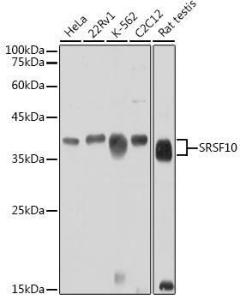 Western blot analysis of extracts of various cell lines, using Anti-SRSF10 Antibody (A305632) at 1:1,000 dilution