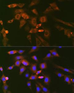 Immunofluorescence analysis of NIH-3T3 cells using Anti-Ube2N / Ubc13 Antibody [ARC1495] (A306899) at a dilution of 1:100 (40x lens). DAPI was used to stain the cell nuclei (blue).