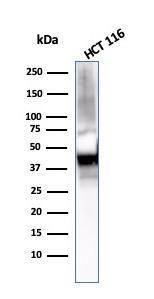 Western blot analysis of HCT116 cell lysate using Anti-Cytokeratin 8 Antibody [KRT8/2115]