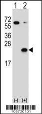 Anti-DUSP3 Rabbit Polyclonal Antibody