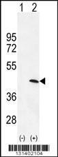 Anti-PRKAG1 Rabbit Polyclonal Antibody (AP (Alkaline Phosphatase))