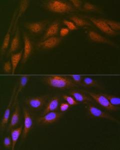 Immunofluorescence analysis of U-2 OS cells using Anti-Ube2N / Ubc13 Antibody [ARC1495] (A306899) at a dilution of 1:100 (40x lens). DAPI was used to stain the cell nuclei (blue).