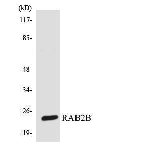 Western blot analysis of the lysates from 293 cells using Anti-RAB2B Antibody