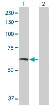 Anti-FGFR1 Rabbit Polyclonal Antibody