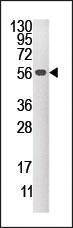 Anti-DUSP4 Rabbit Polyclonal Antibody [clone: 358CT10.3.6]