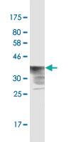 Anti-POLR2A Mouse Monoclonal Antibody [clone: 1F17]