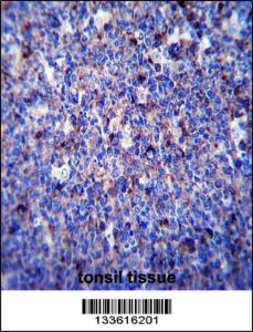 Anti-MMP3 Rabbit Polyclonal Antibody