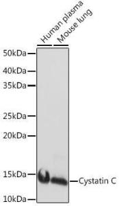 Anti-Cystatin C Rabbit Monoclonal Antibody [clone: ARC1357]