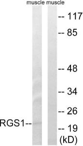 Western blot analysis of lysates from mouse muscle cells using Anti-RGS1 Antibody The right hand lane represents a negative control, where the antibody is blocked by the immunising peptide