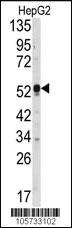 Anti-DUSP4 Rabbit Polyclonal Antibody [clone: 358CT10.3.6]