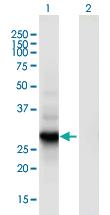 Anti-RGS18 Mouse Monoclonal Antibody [clone: 1G12]