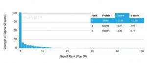 Analysis of protein array containing more than 19,000 full-length human proteins using Anti-S100 beta Antibody [S100B/4138