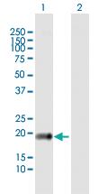 Anti-CLDN14 Rabbit Polyclonal Antibody