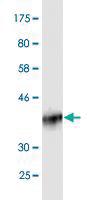 Anti-ZNF622 Mouse Monoclonal Antibody [clone: 4G6]