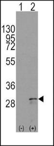 Anti-KITLG Rabbit Polyclonal Antibody (Biotin)