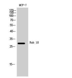 Western blot analysis of MCF 7 cells using Anti-RAB18 Antibody