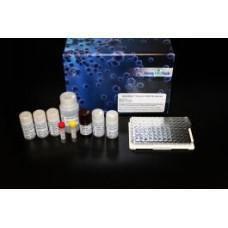 Western blot analysis of lysates from MCF-7 and Jurkat cells using Anti-OXER1 Antibody. The right hand lane represents a negative control, where the antibody is blocked by the immunising peptide