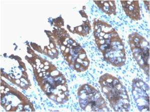 Immunohistochemical analysis of formalin-fixed, paraffin-embedded human colon using Anti-Cytokeratin 8 Antibody [rB22.1]