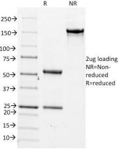 SDS-PAGE analysis of Anti-CD14 Antibody [LPSR/2386] under non-reduced and reduced conditions; showing intact IgG and intact heavy and light chains, respectively. SDS-PAGE analysis confirms the integrity and purity of the Antibody