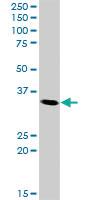 Anti-CDK5 Rabbit Polyclonal Antibody