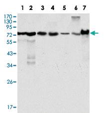 Anti-LPP Mouse Monoclonal Antibody [clone: 8B3A11]