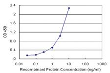 Anti-ECHS1 Antibody Pair