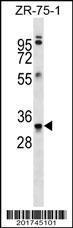 Anti-MBP Mouse Monoclonal Antibody [clone: 408CT17.4.3]