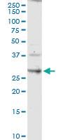 Anti-CLDN14 Rabbit Polyclonal Antibody